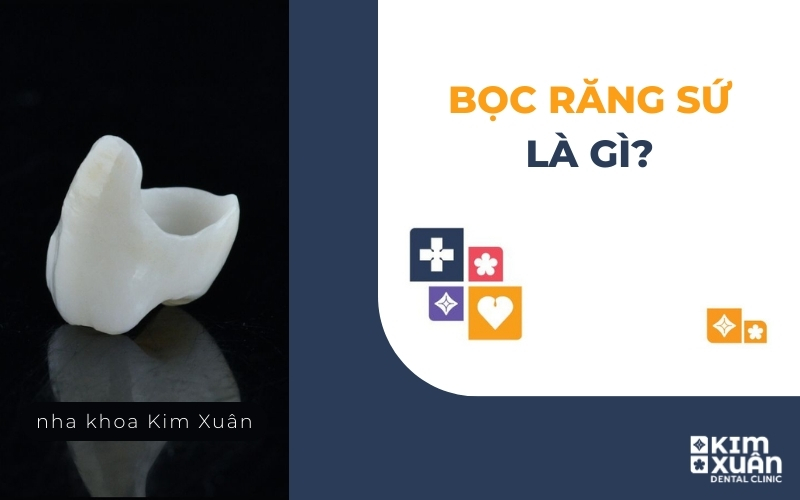 Bọc Răng Sứ Là Gì