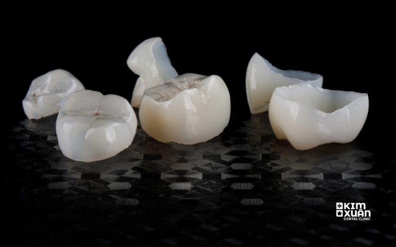Bọc Răng Sứ Nha Khoa Kim Xuân