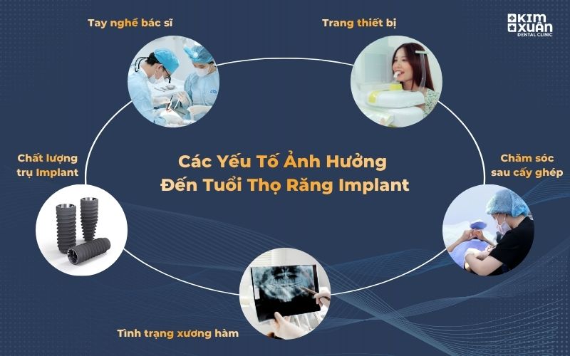 Các Yếu Tố Ảnh Hưởng Đến Tuổi Thọ Răng Implant