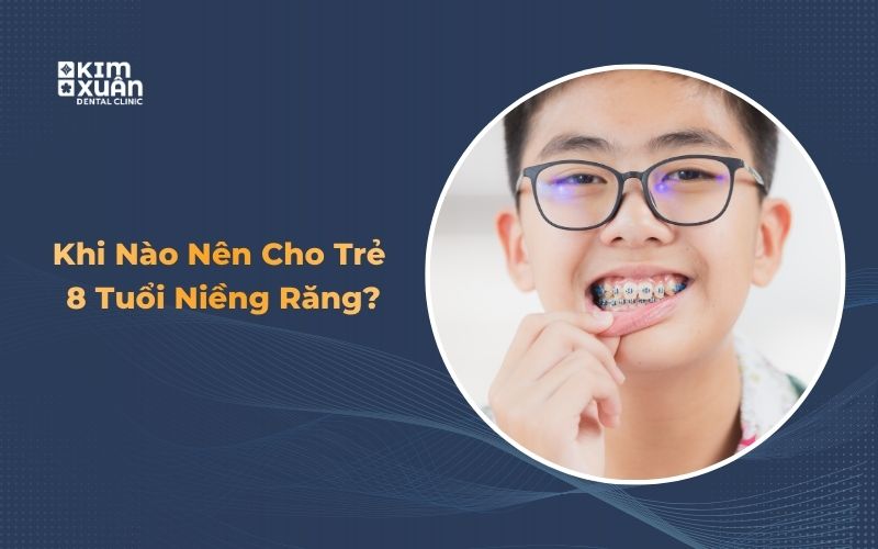 Có Nên Niềng Răng Cho Trẻ 8 Tuổi Không