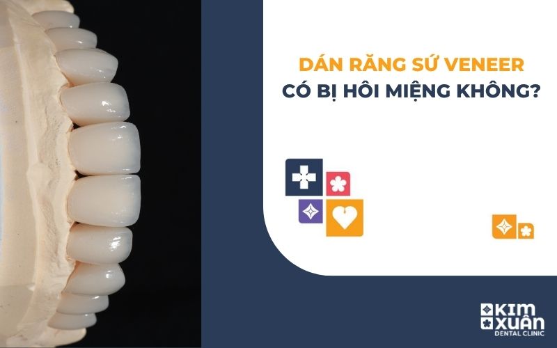 Dán Răng Sứ Veneer Có Gây Hôi Miệng Không