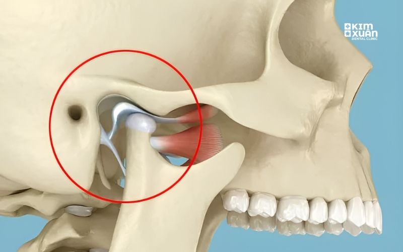 Dấu Hiệu Đau Khớp Thái Dương Hàm
