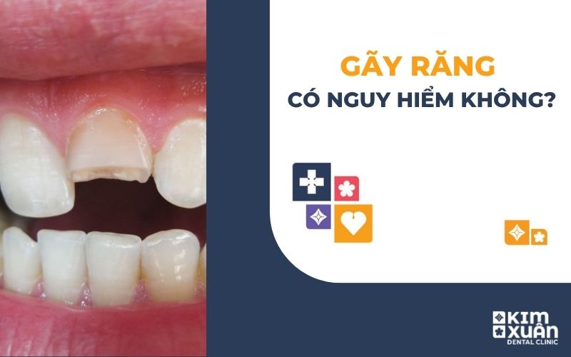 Gãy Răng Có Nguy Hiểm Không