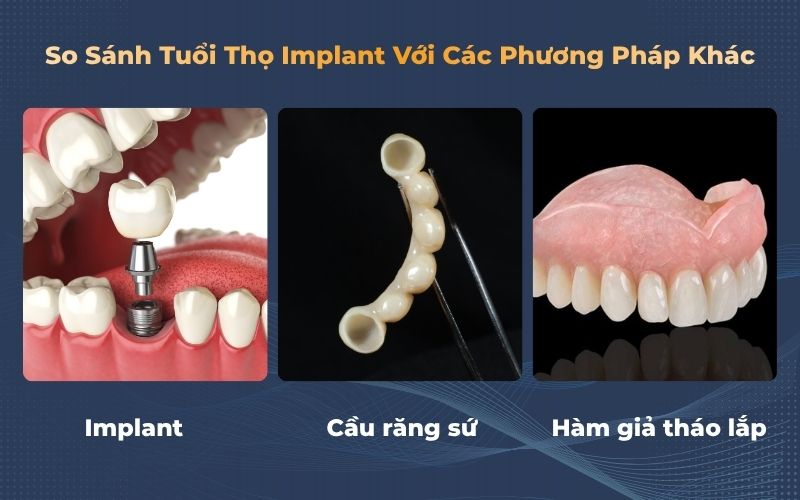 Hình Ảnh Cấy Ghép Implant Cầu răng Sứ Và Hàm Giả Tháo Lắp