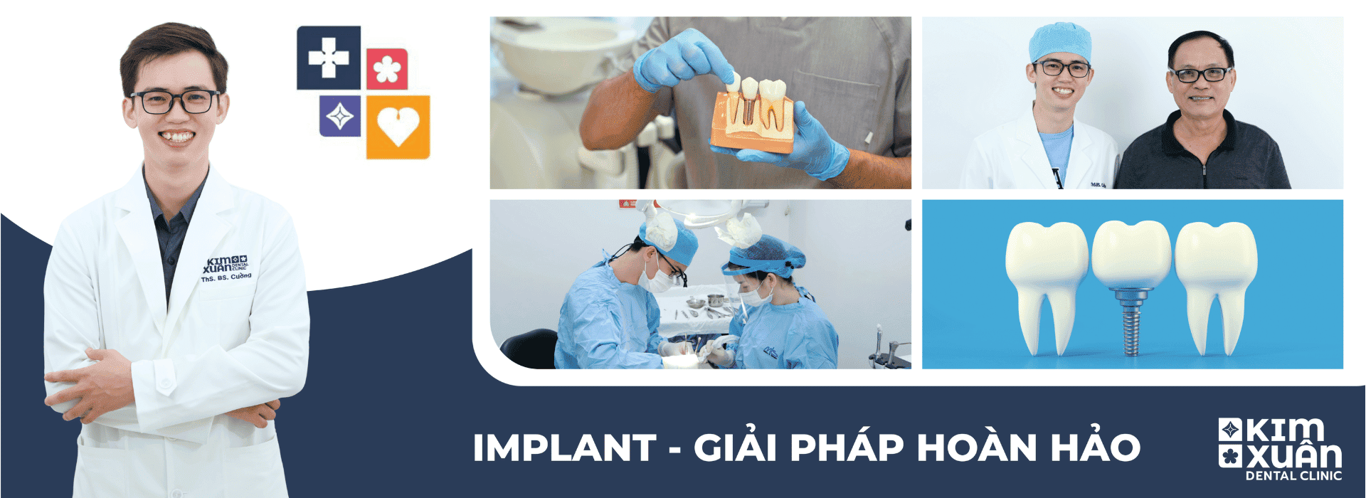 Implant - Giải Pháp Phục Hình Răng Toàn Diện -