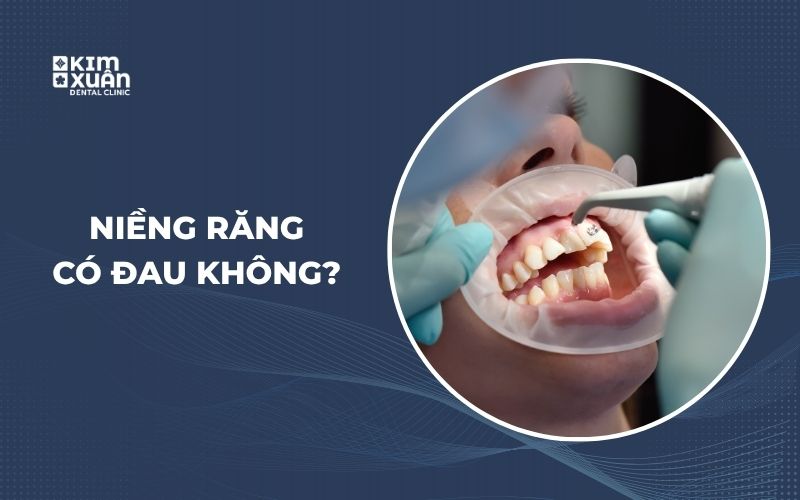 Niềng Răng Có Đau Không