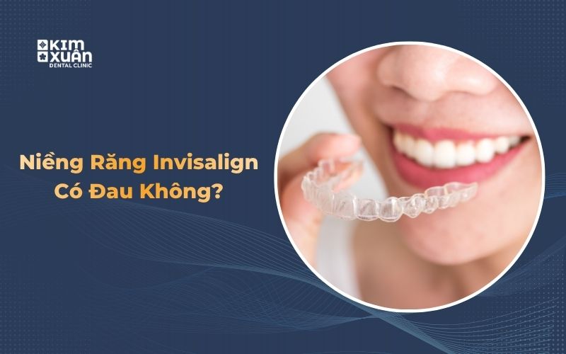Niềng Răng Máng Invisalign Có Đau Không