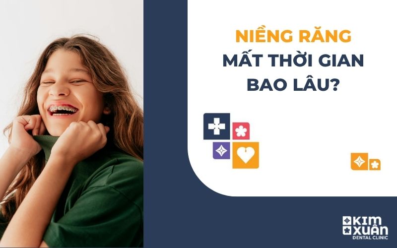 Niềng Răng Mất Bao Lâu