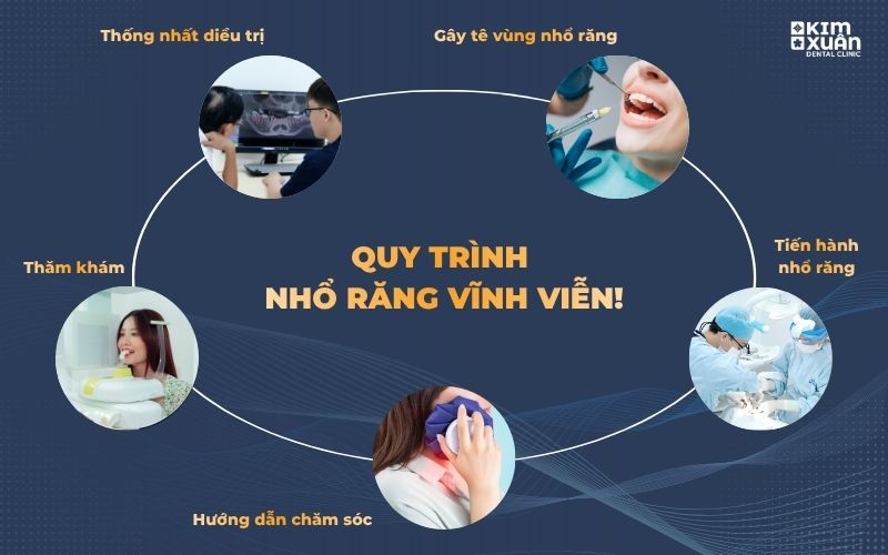 Quy Trình Nhổ Răng Chuẩn Y-Khoa