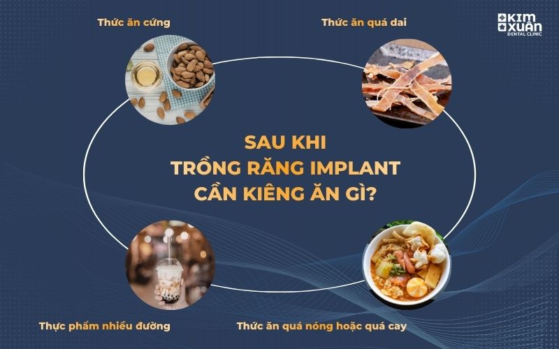 Sau Khi Trồng Răng Implant Nên Kiêng Ăn Gì