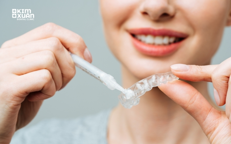 Tẩy Trắng Răng Tại Nhà