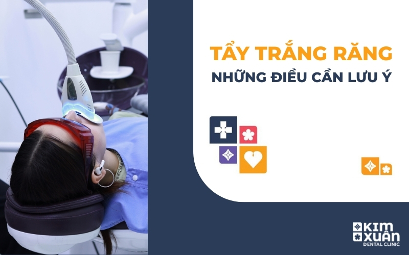 Tẩy Trăng Răng Tại Nha Khoa Kim Xuân