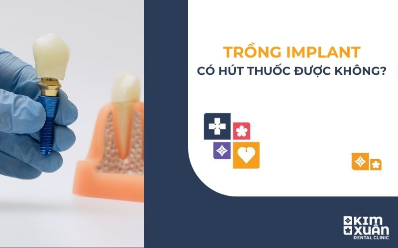 Trồng Răng Implant Có Hút Thuốc Được Không
